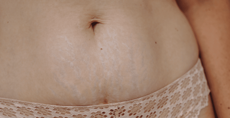 Postpartum lichaam na de bevalling (How About Mom)