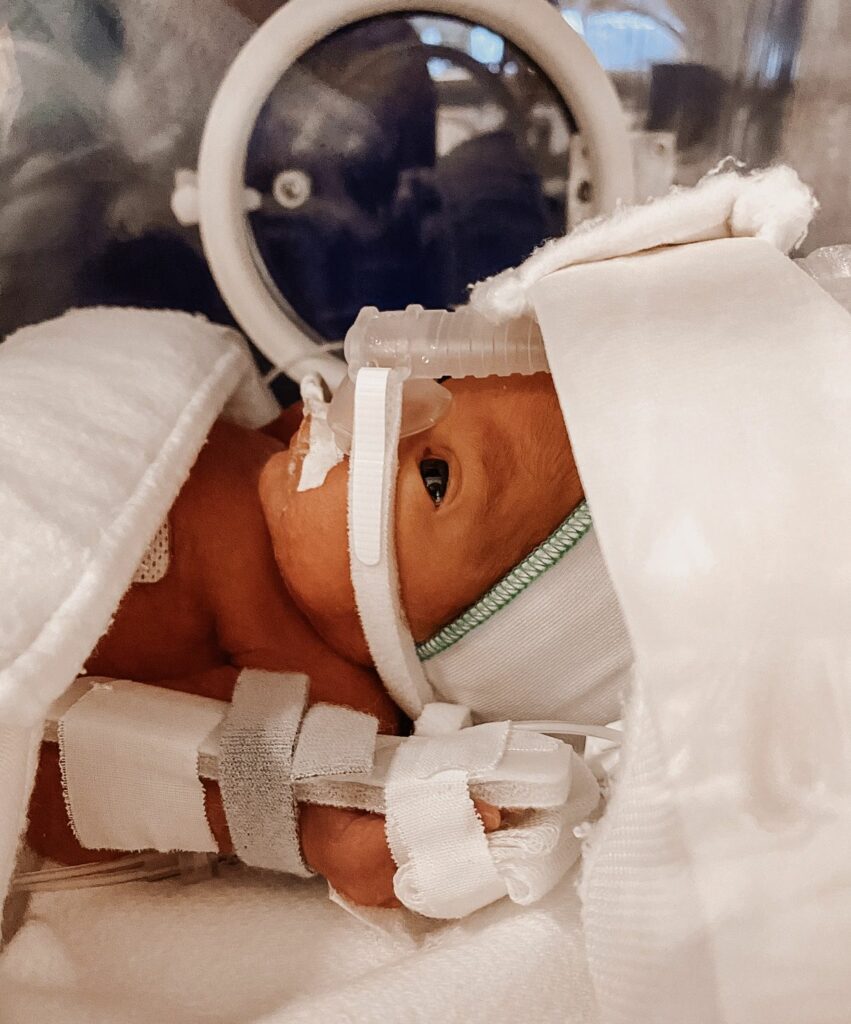  foto baby te vroeg geboren 29 weken 