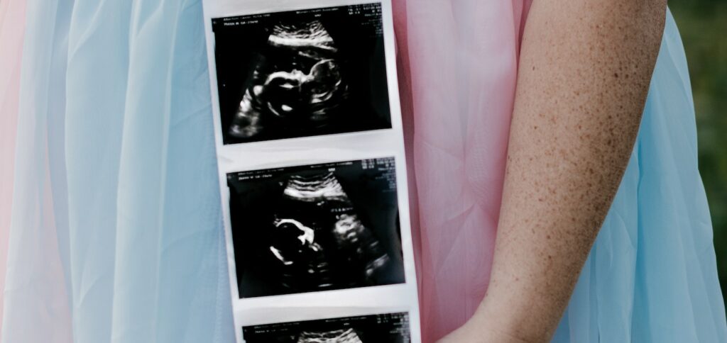Echo's en prenatale screening