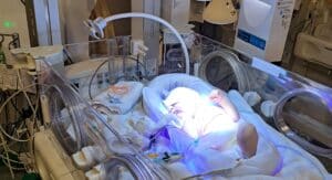 rhesus baby