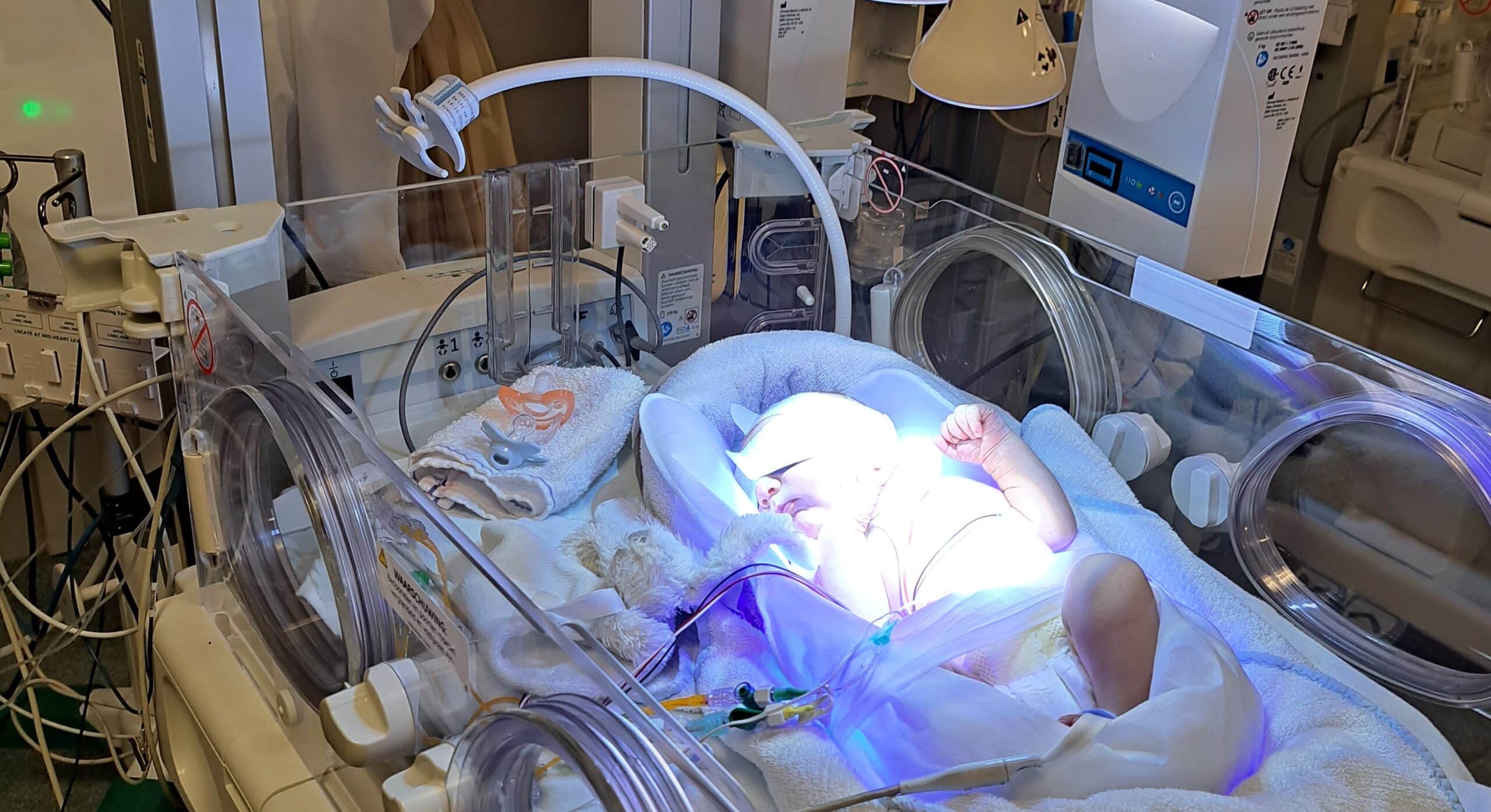 rhesus baby