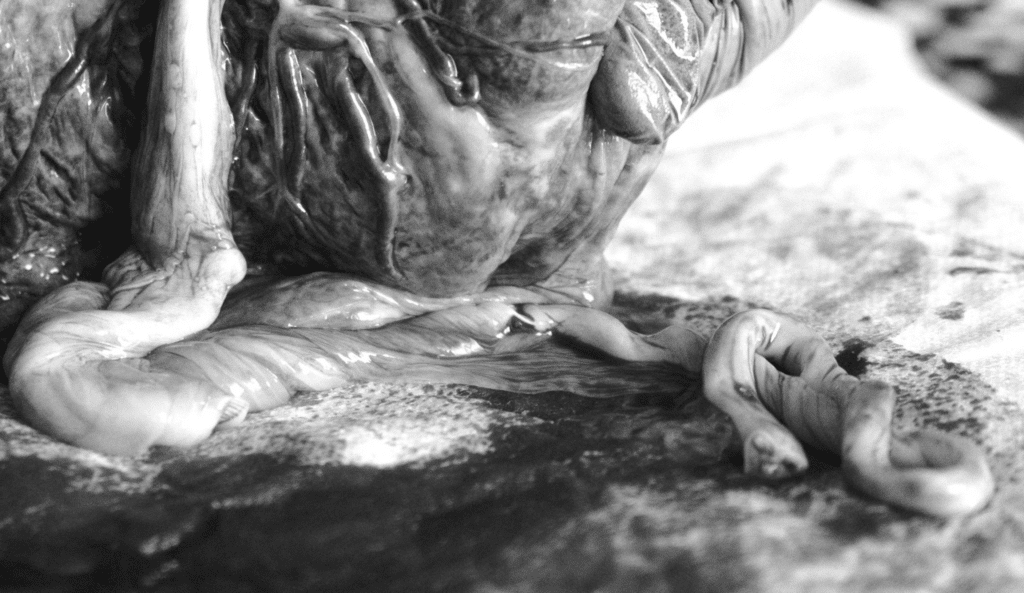 navelstreng en placenta (foto: Stories of New Life)